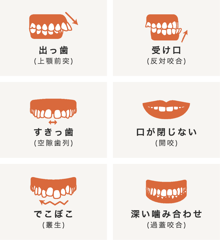 対応可能な歯並び