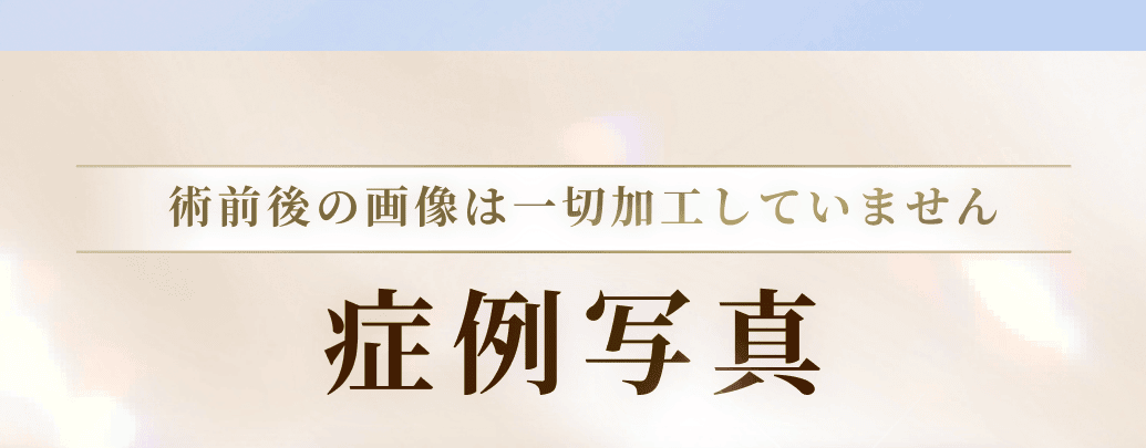 術前後の画像は一切加工していません。症例写真