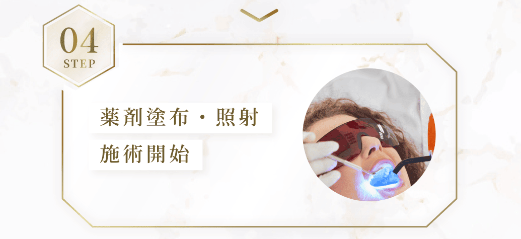 STEP04。薬剤塗布・照射施術開始