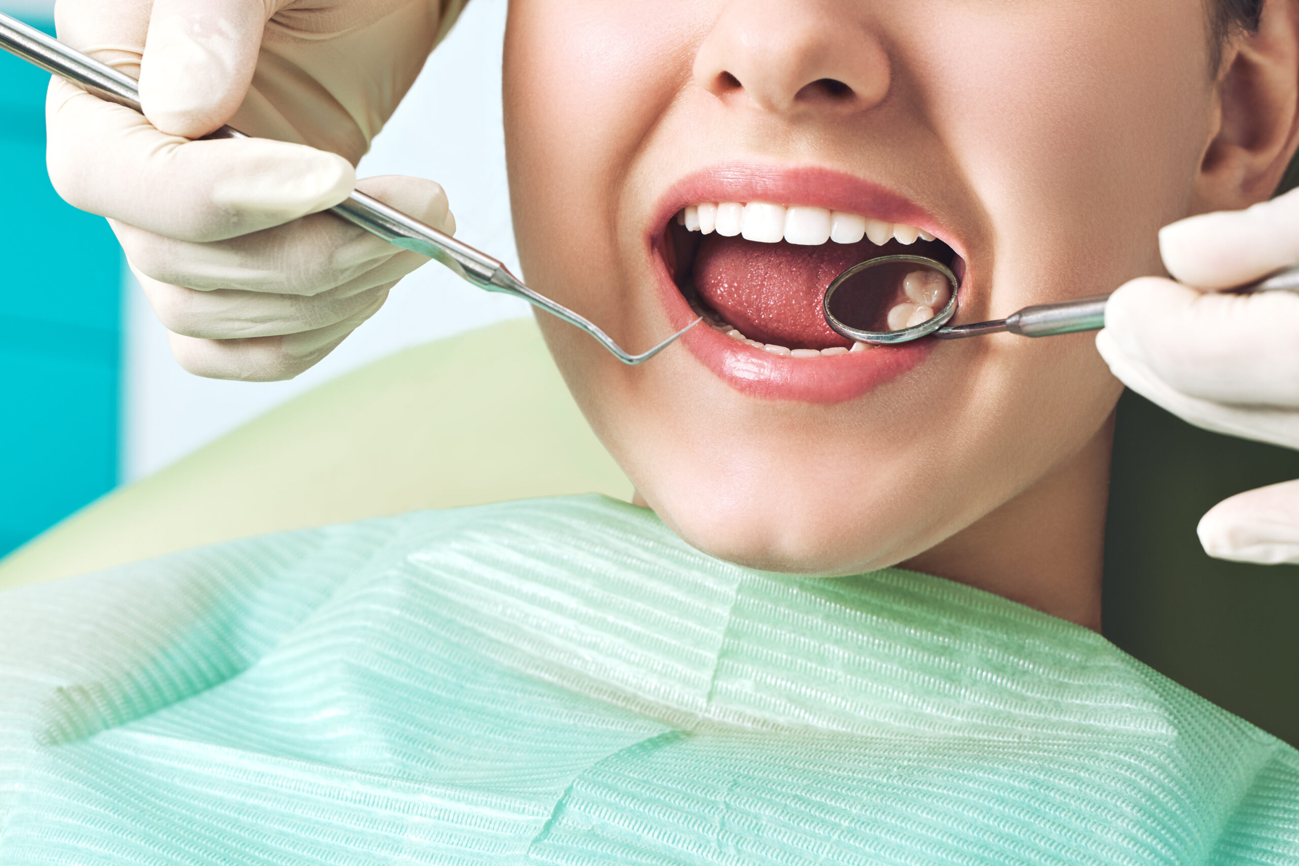 女性が歯科医院で口を開けて治療している