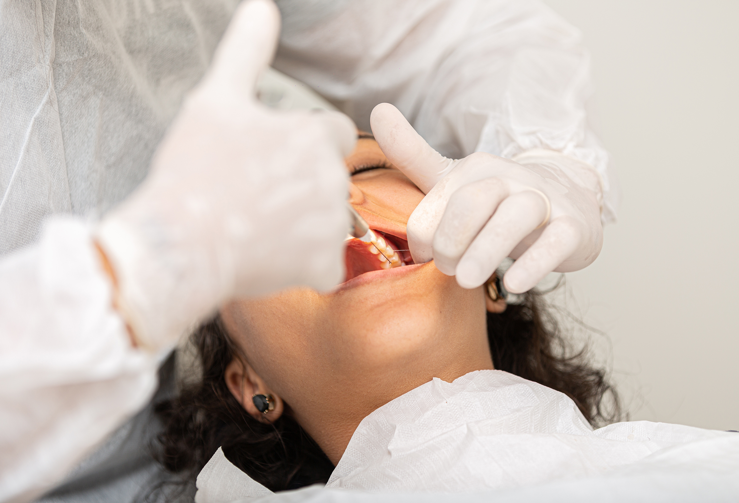 歯医者で抜歯する女性