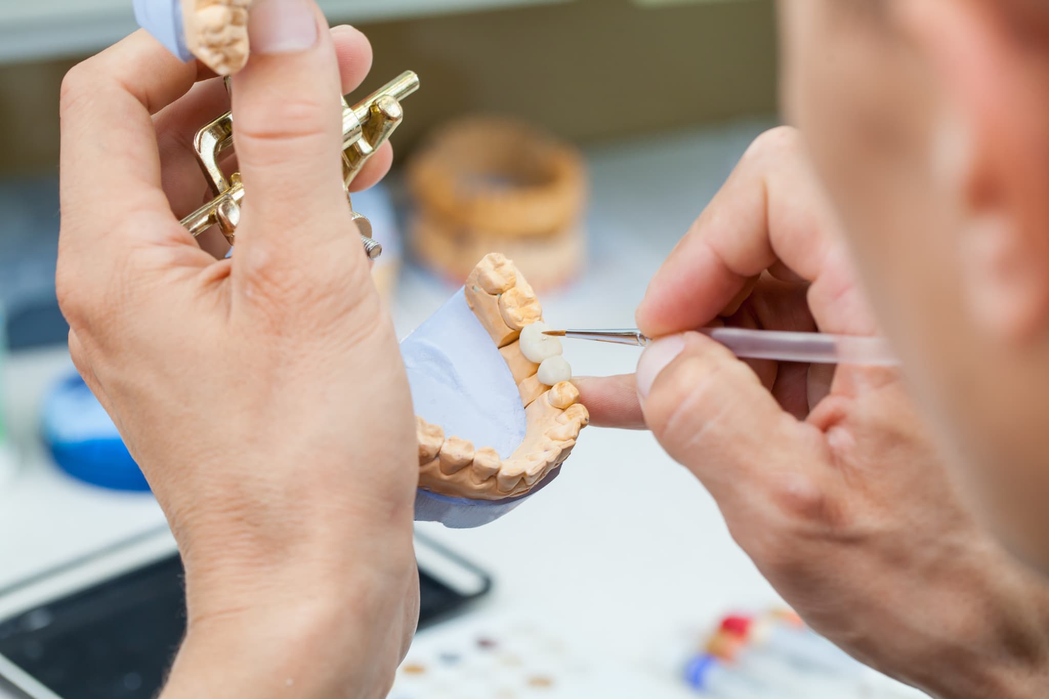 歯科技工士がセラミックの歯を作製する様子