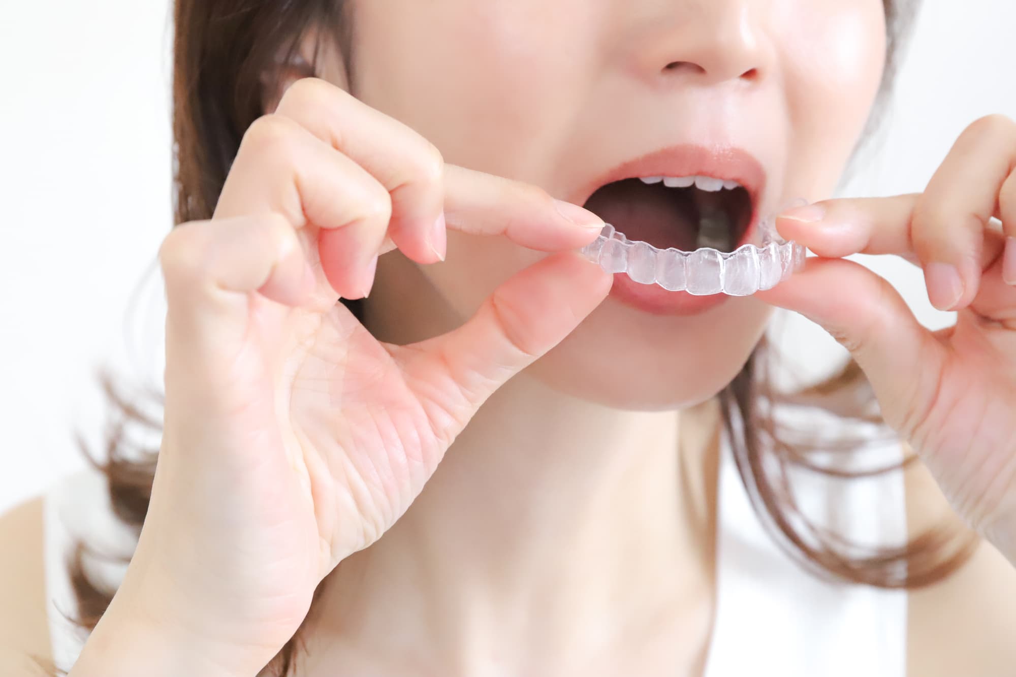 両手でマウスピースを持ち装着しようとしている女性の口元