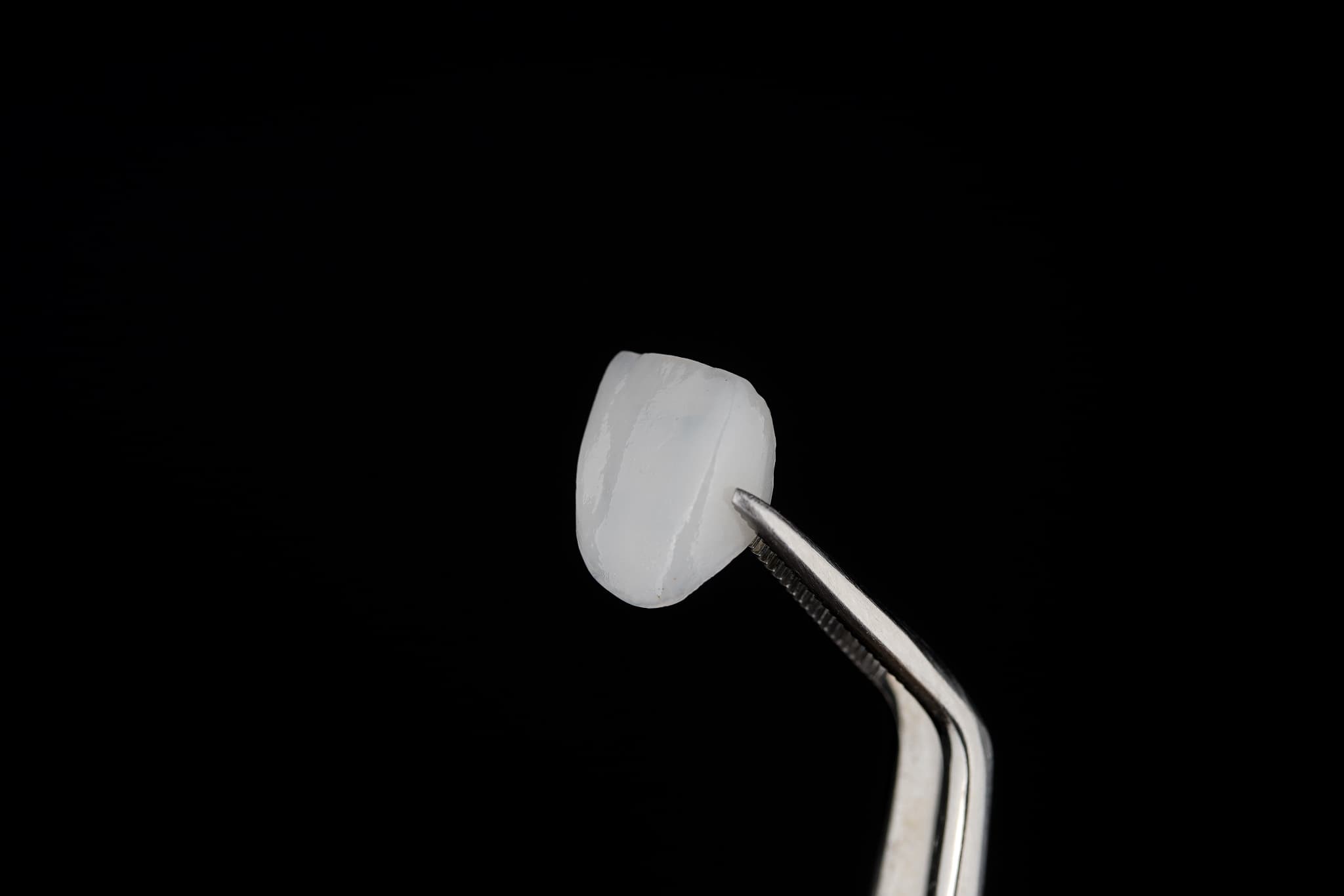 ピンセットでつまんだラミネートべニア