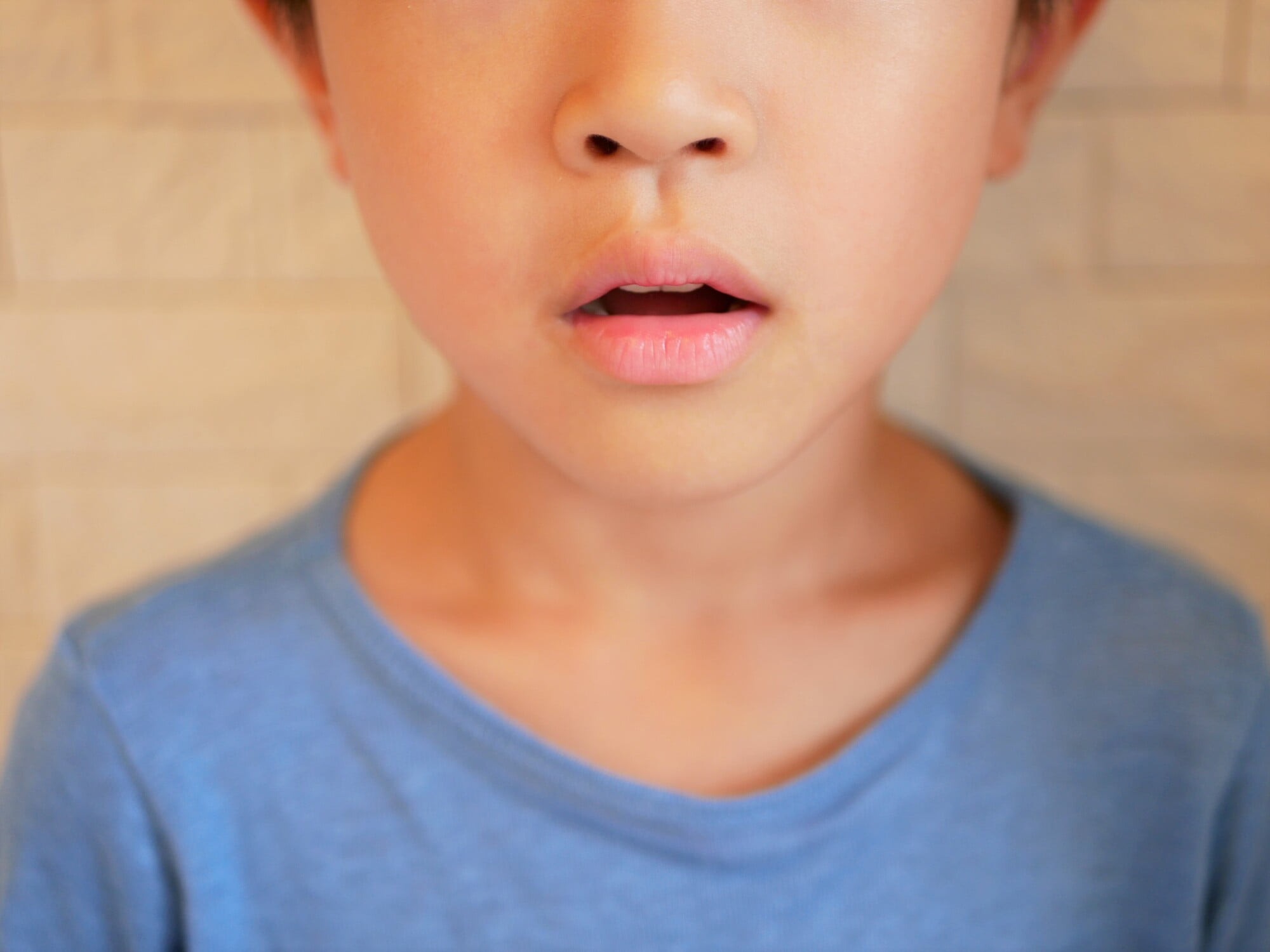 口呼吸をする子どもの口もと