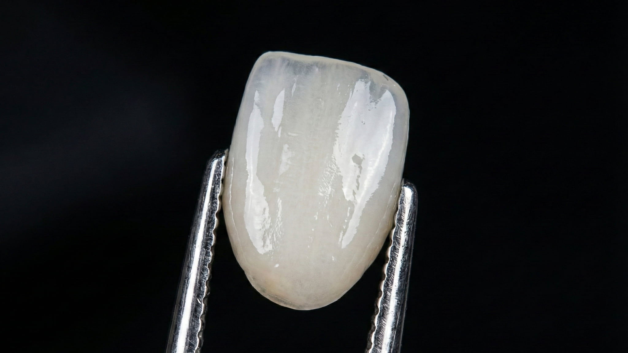 下の歯用のラミネートベニアのイメージ