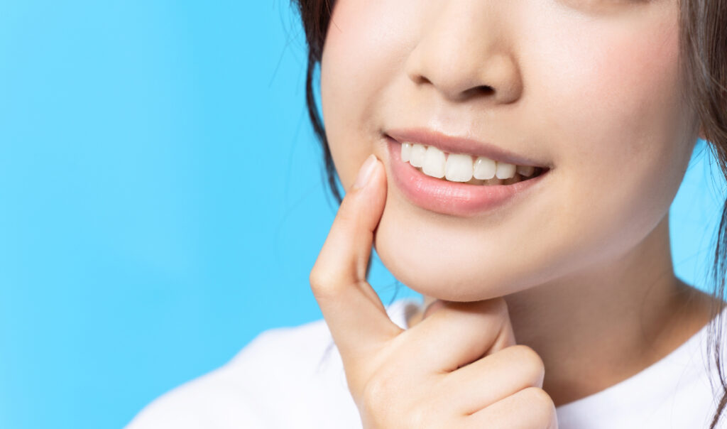 ラミネートベニアをした歯